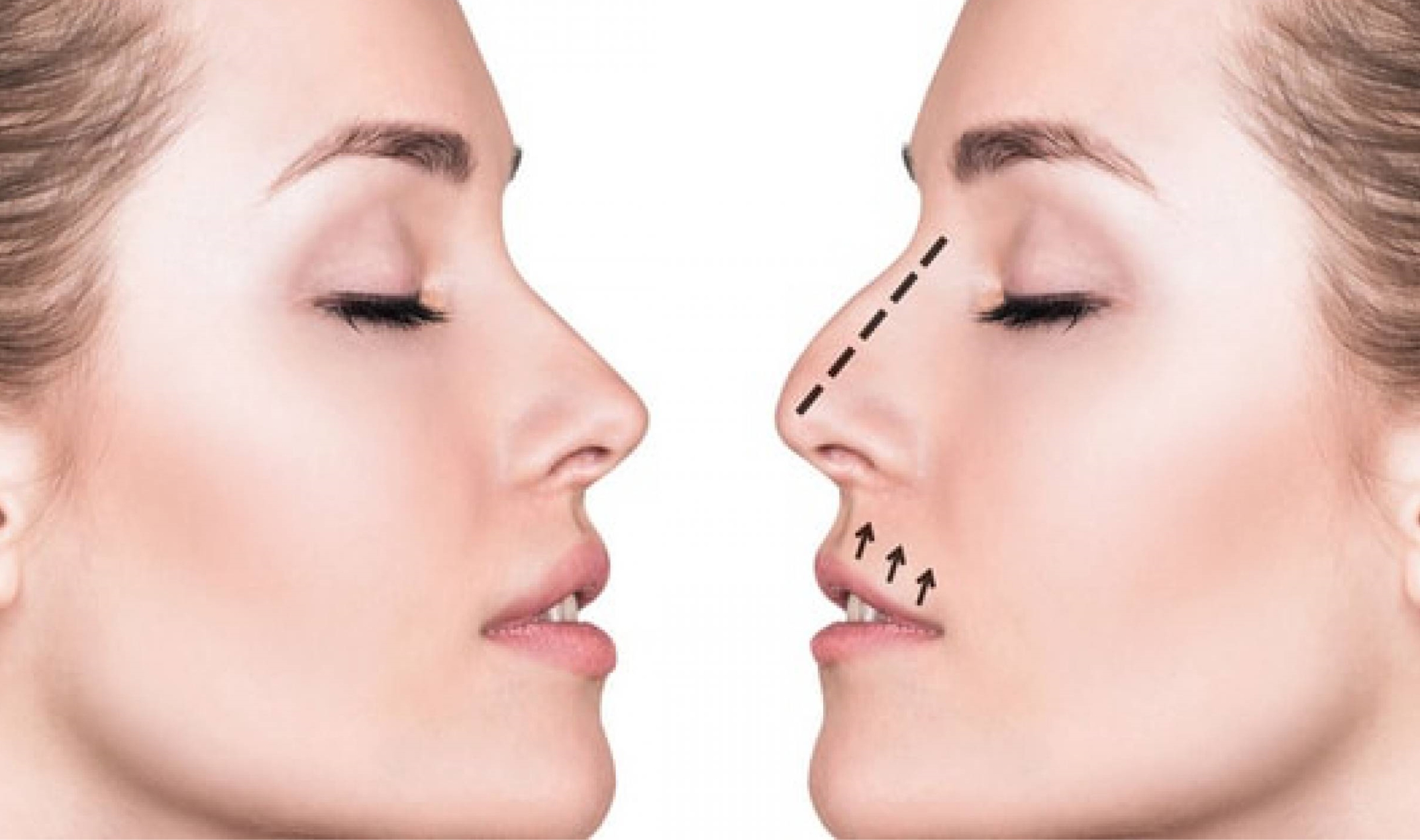 Why plastic surgery is important MEDIX.do